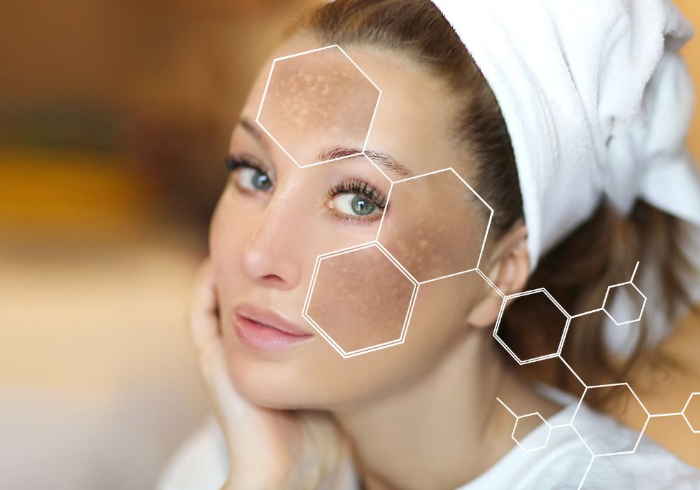 Clareador de Manchas Kit Tranexâmico, Mandélico & Resveratrol Zaniah Z16 Clareador de Manchas Kit Tranexâmico, Mandélico & Resveratrol Zaniah Z16