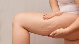 Intradermoterapia Pressurizada o que é, como funciona e para que serve