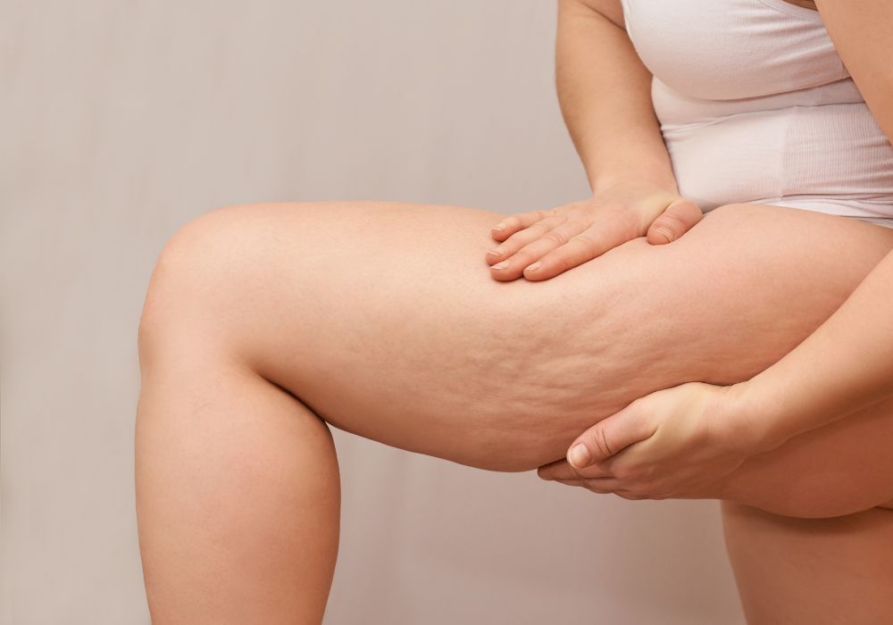 Intradermoterapia Pressurizada o que é, como funciona e para que serve Intradermoterapia Pressurizada o que é, como funciona e para que serve