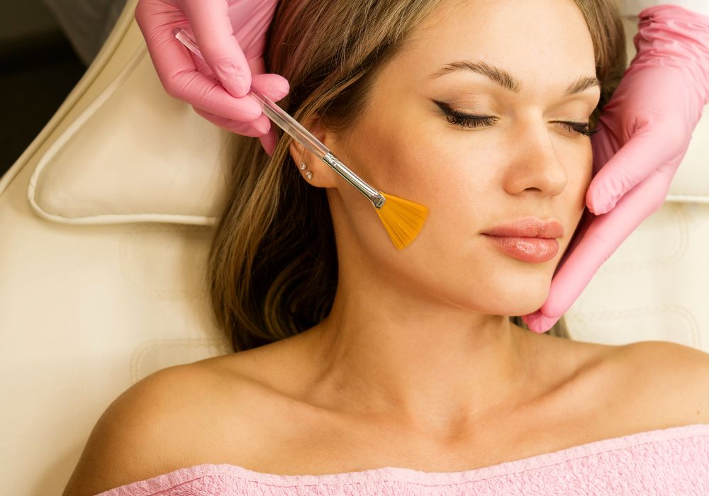 Afinal, qual o melhor peeling para manchas