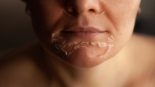 Qual o Melhor Peeling para Manchas Descubra o Segredo da Pele Uniforme