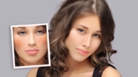 Melhor Despigmentante para Melasma Tratamentos, Produtos e Dicas