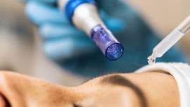 Microagulhamento com Drug Delivery - O que é e Como Funciona