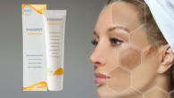 Thiospot Intensive Funciona Análise do Clareador de Melasma